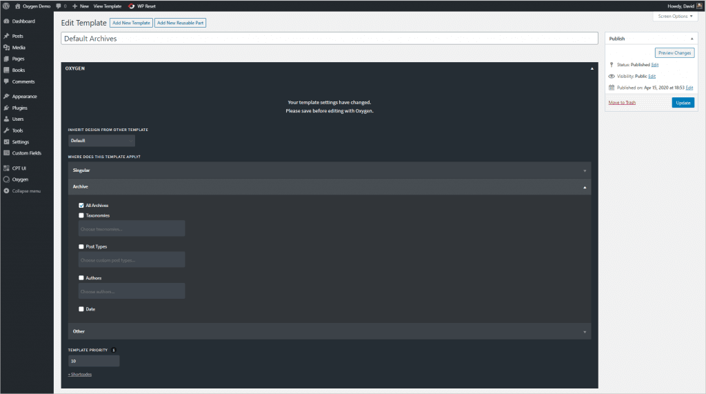 Add Default Archive Template